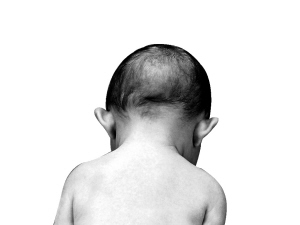父親高齡易生孤獨癥兒(圖)